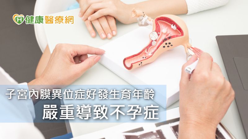 嚴重子宮內膜異位症想懷孕？　醫籲治療後「越快越好」_瘦身